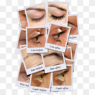 Why Is Castor Oil So Special - Rapid Lash Clipart