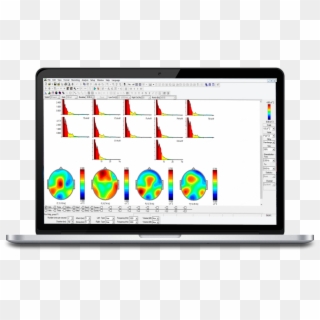 Macbook-wineeg Analytics Screen - Software Clipart