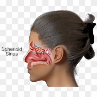 The Septum Is A Thin Bone That Separates Both Sides - Girl Clipart