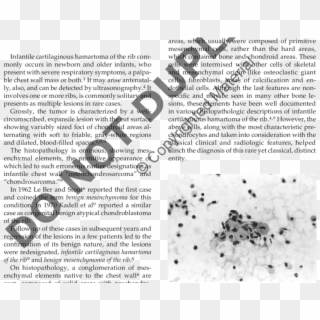 Osteoclastic Giant Cells And Syncytial Prechondrocytic - Pap Test Clipart