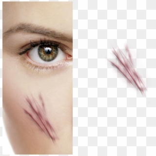 Create Scratches - Stitches On Face Png Clipart