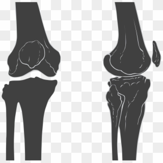 Bone Densitometry Scan - Knee Skeleton Clipart