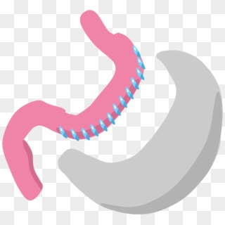Gastric Sleeve Icon - Gastrectomy Png Clipart