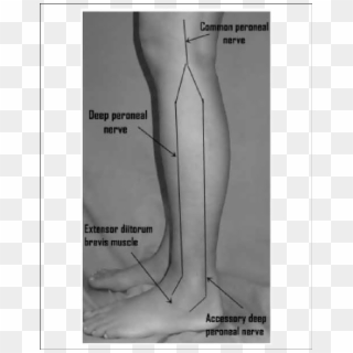 The Accessory Deep Peroneal Nerve - Stimulate Deep Peroneal Nerve Clipart