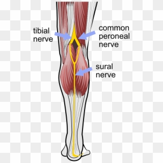 Sural Nerve, Common Peroneal Nerve, Tibial Nerve - Sural Nerve Tibial Nerve Clipart