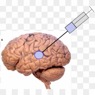 Brain2 - Nbme 15 Brain Clipart
