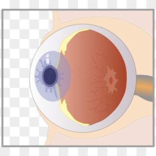 Small - Eye Diagram No Background Clipart