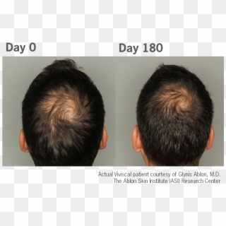 Viviscal Hair Growth Vitamins - Viviscal Men Clipart