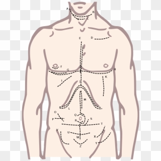 Incisions Of The Torso - Upper Body Male Diagram Clipart