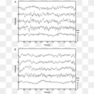 Eeg Record From The Flying And Resting Pigeon (b) That - Handwriting Clipart