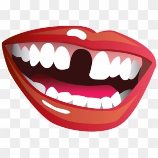 Smile With Missing Tooth Clipart