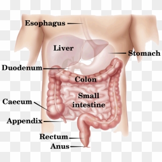 Digestive Tract - Colon Cancer Clipart