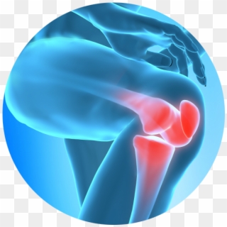 Chronic Joint Pain Slowing You Down Learn How Regenerative - Knee Pain In Png Clipart