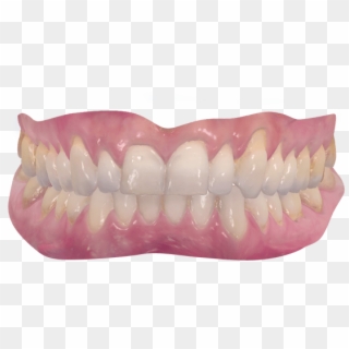 The Challenges Of The Digital Implant World - Realistic Mouth Transparent Clipart