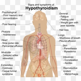 In Fact, If You Go To Your Psychiatrist Or Family Doctor - Differences Between Hypothyroidism And Hyperthyroidism Clipart