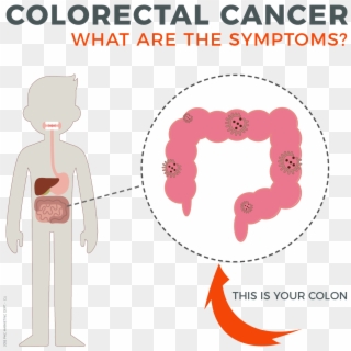 Symptoms Of Colorectal Cancer, The Body's Digestive - Human Body Clipart