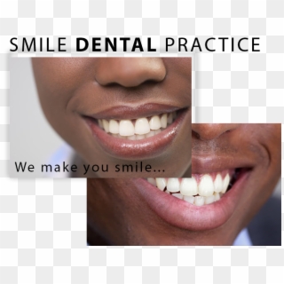 Smile Dental Group - Photo Caption Clipart