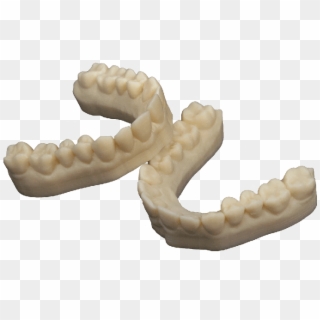 Dental Model By 3d Printing For Dental Crowns & Bridges - 3d Printed Dental Model Clipart