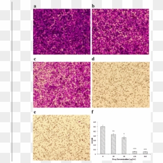Effect Of Oridonin On Huvec Migration - Glitter Clipart