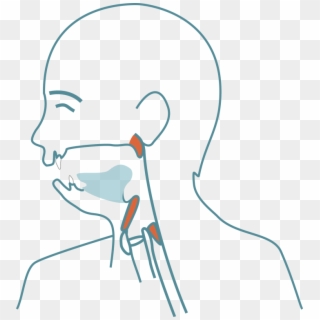 Abnormal Bite- And Jaw Development - Drawing Clipart