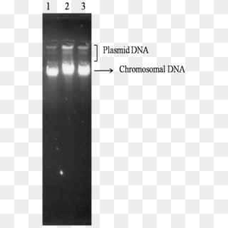 Electrophoresis Pattern Of Genomic Dna Of Clinically - Chromosomal Dna Gel Electrophoresis Clipart