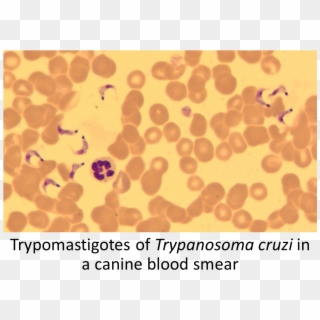 Trypanosoma Cruzi Method Of Diagnosis Find Amastigotes - Circle Clipart