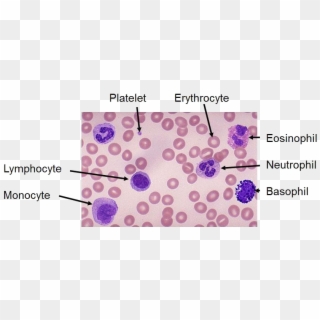 Blood Film - Neutrophil Vs Lymphocyte Clipart