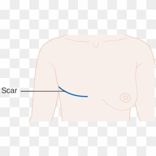 “i Know Why I Have The Scars That I Do, And The Bottom Clipart
