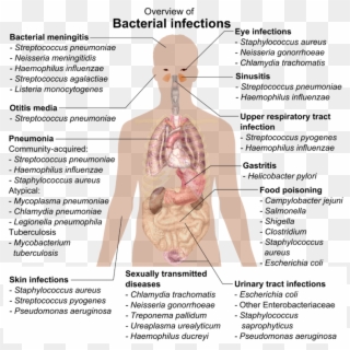 Bacterial Infections And Involved Species - Overview Of Bacterial Infections Clipart